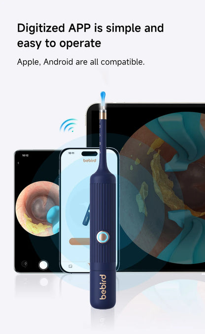 Otoscopem HD Plus EarGuardian Tweezers Clipable Earpick Wireless Cleaning Endoscope with Camera 1080P.